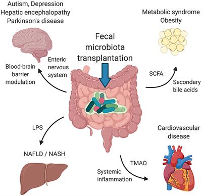 Fecal Microbiota Transplantation as a Tool for Therapeutic Modulation of Non-gastrointestinal Disorders